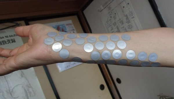 手首をひねると痛いの原因写真