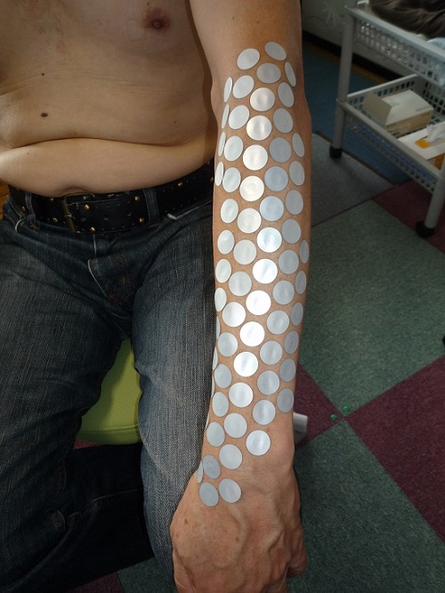 手をそらすと手首が痛い事例