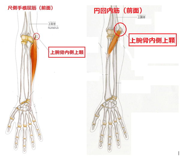 上腕骨内側上顆炎
