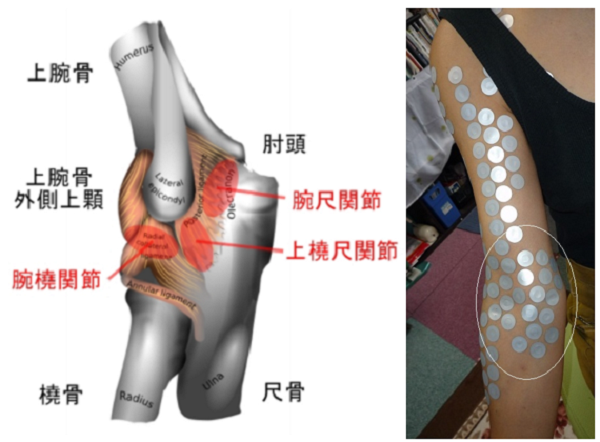 肘関節が痛いの原因と解消方法