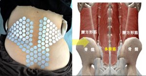 腰の仙骨部分が痛い原因は多裂筋にあった!慢性腰痛を根本改善するセルフケアと再活性化トレーニング完全ガイド 3