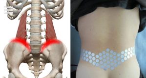 腰を反ると骨盤の付け根が痛い原因は腰方形筋の付着部にあった!症状別セルフケアと改善ストレッチ完全ガイド 3