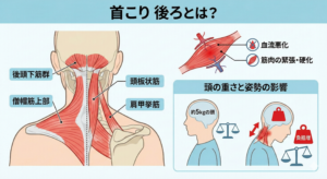 首こり 後ろがつらい原因と即効セルフケア完全ガイド 頭痛や目の疲れを根本改善するストレッチと予防法まで徹底解説 2