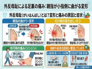 足裏痛い 親指の原因を徹底解説 歩くとズキッと痛む母趾球の正体と考えられる病気 自宅でできる対処法と受診の目安まで完全ガイド 5