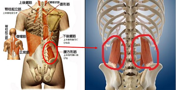 骨盤が歪む原因となる筋肉