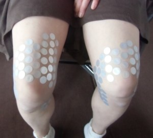 膝の皿の上が痛い状態を確認した写真