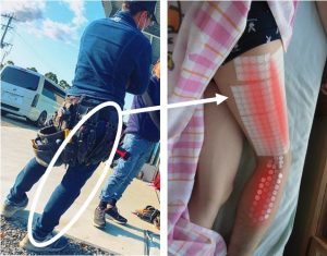 座骨神経痛の多くは職業病