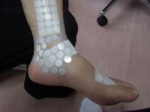 足首の内くるぶし周辺が痛い原因は長趾屈筋・長母趾屈筋にあった!症状別セルフケアと改善ストレッチ完全ガイド 5
