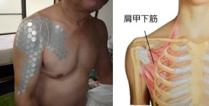 巻き肩が原因で腕が後ろに回せない?肩甲下筋の短縮チェックとストレッチ 3